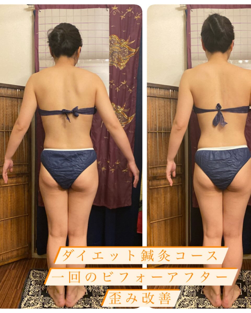 はりきゅう　りおしな