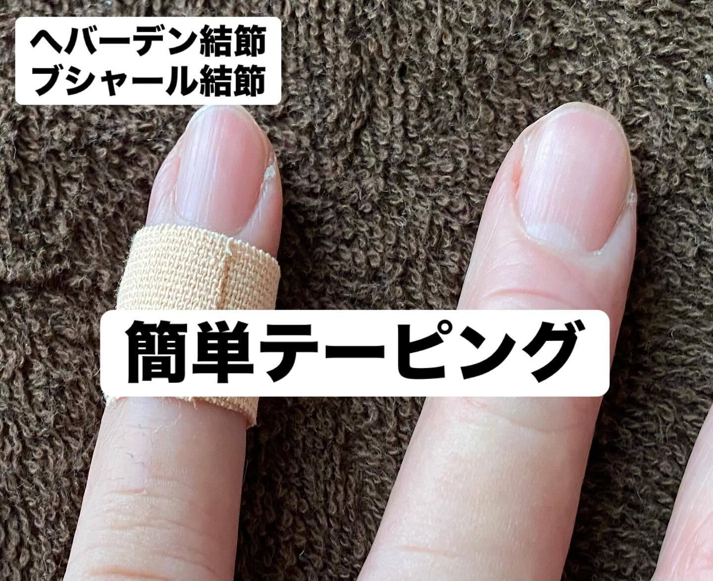 へバーデン結節