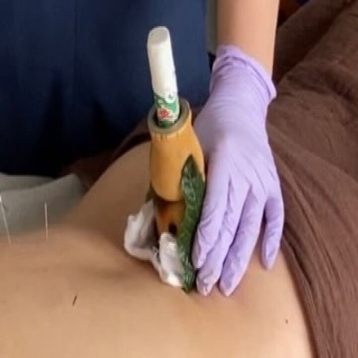 🌿 薬木の王様「枇杷」の葉温灸：その知られざる力と健康効果